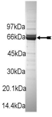 SDS PAGE (ROCK1-216H).jpg